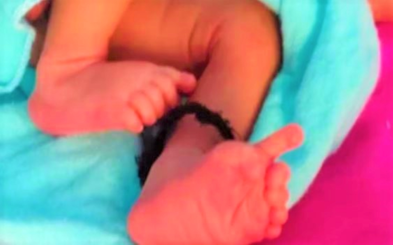 भरतपुर में 26 उंगलियों वाली बच्ची ने लिया जन्म, डॉक्टर हैरान